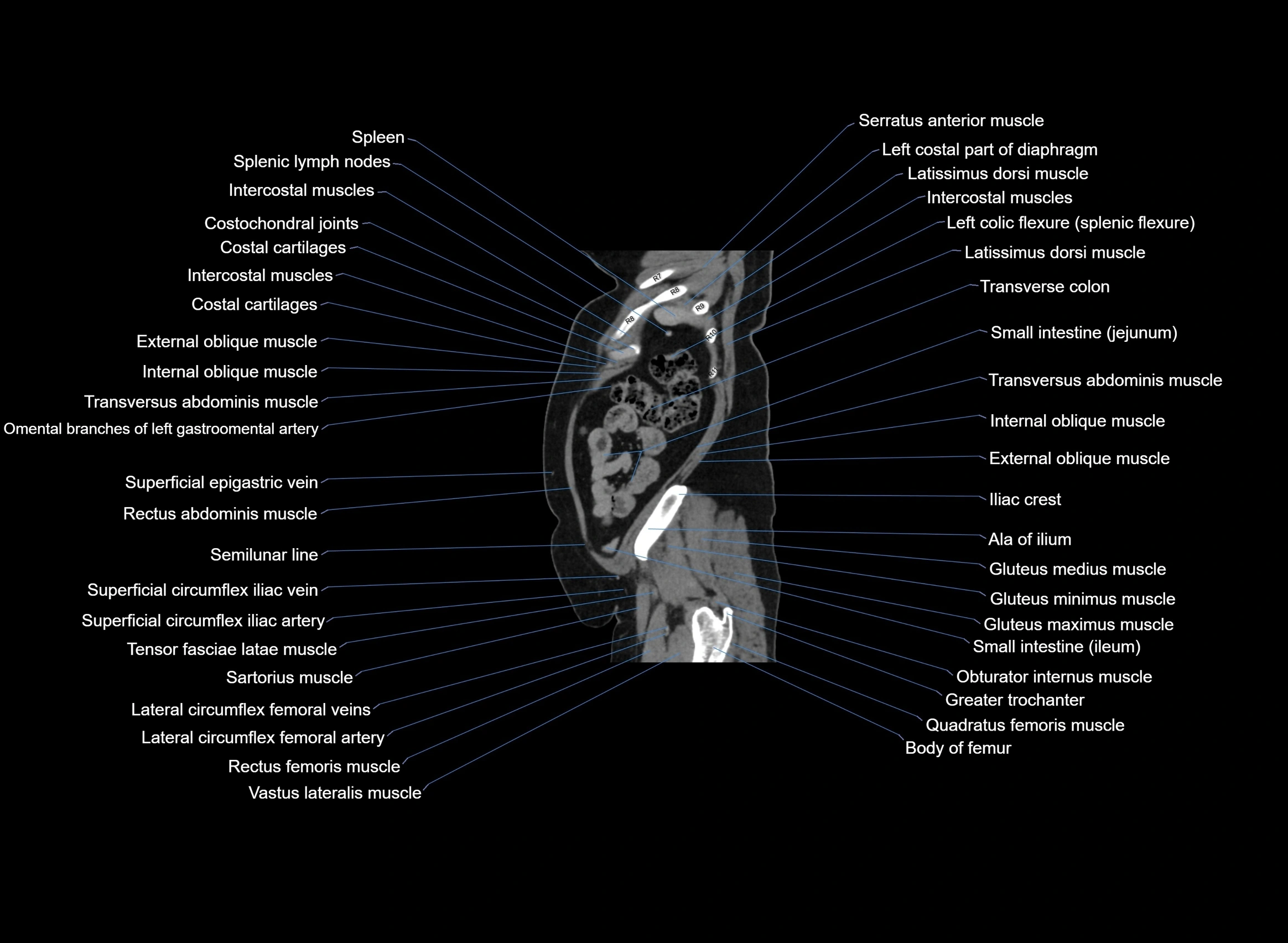 CT Abdomen sagittal cross sectional anatomy labelled radiology image -00018.webp
